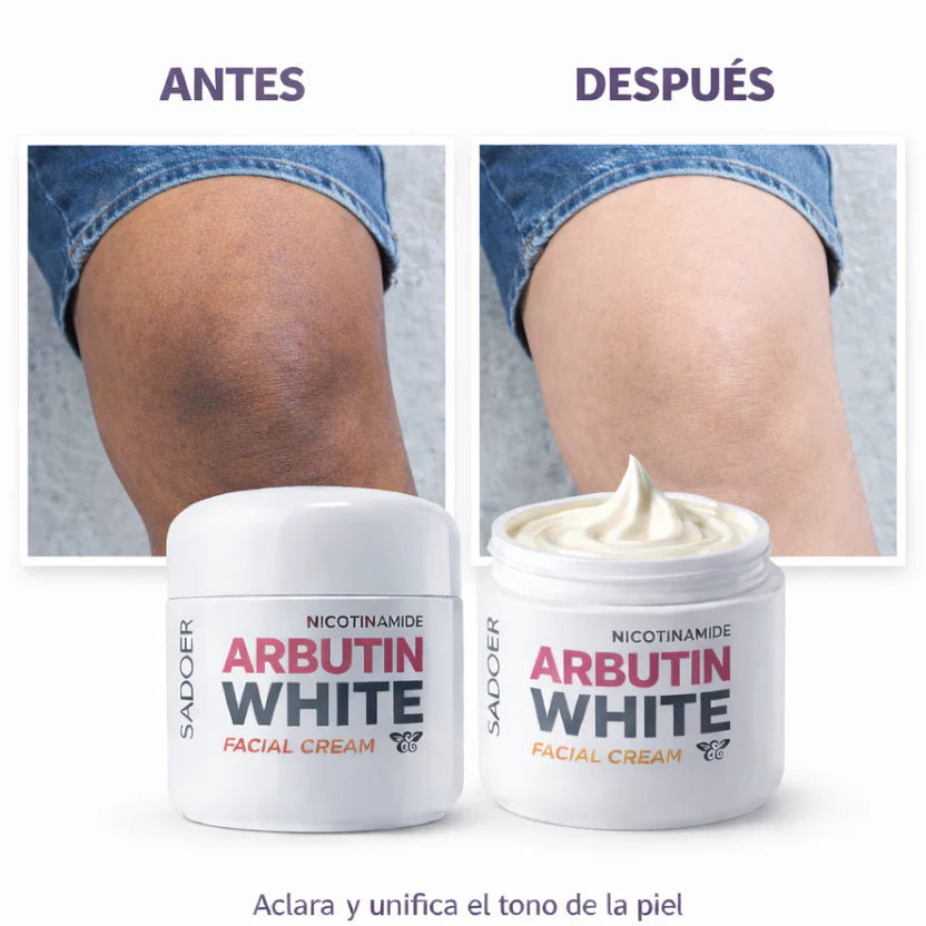 Arbutin White - ¡COMPRA 1 Y LLEVA EL SEGUNDO CON DESCUENTO!✨